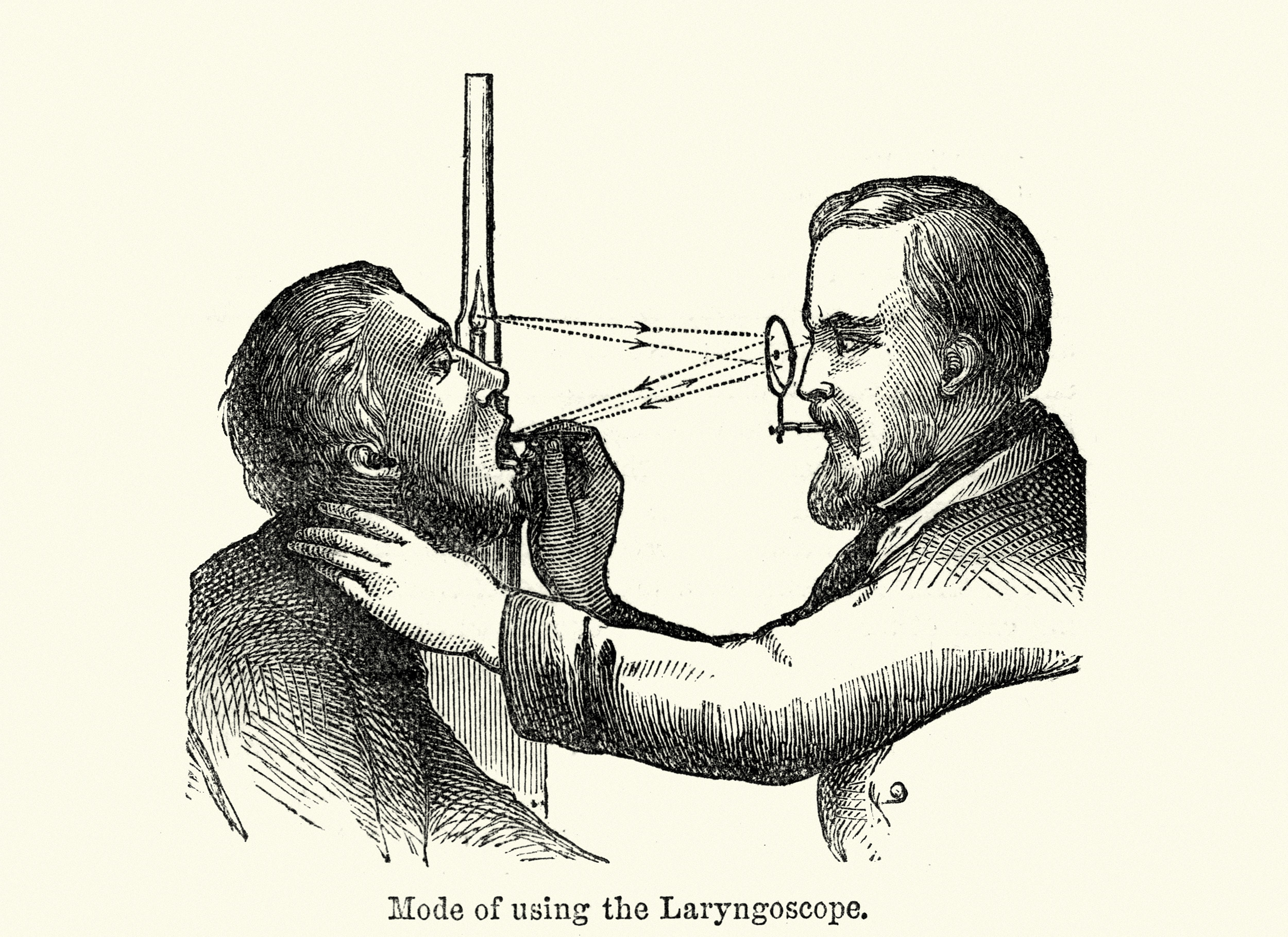 A sketch of a Victorian endoscopist. 