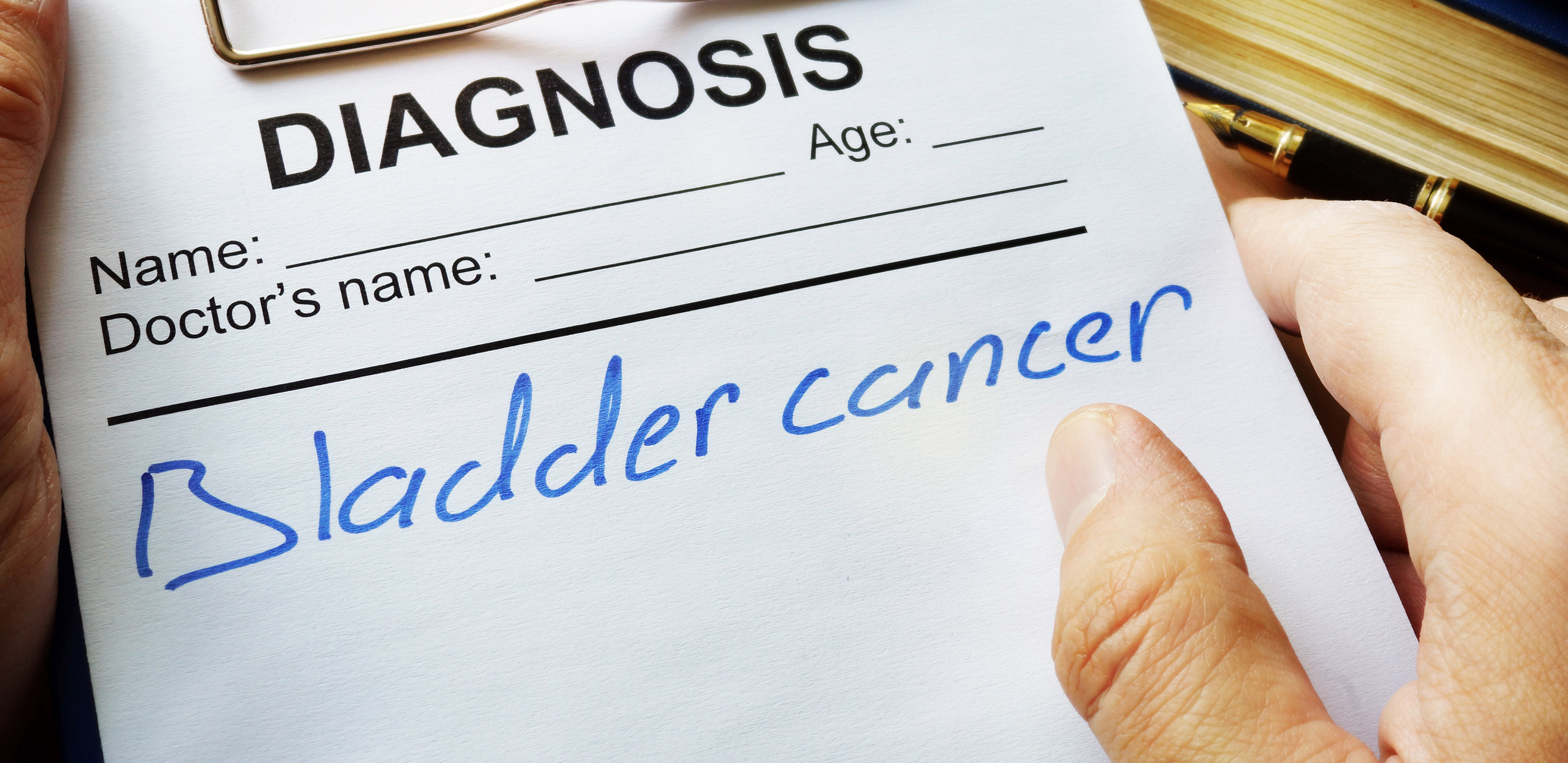 Why 10 Percent of Bladder Cancer Cases are Considered ‘Occupational’ 